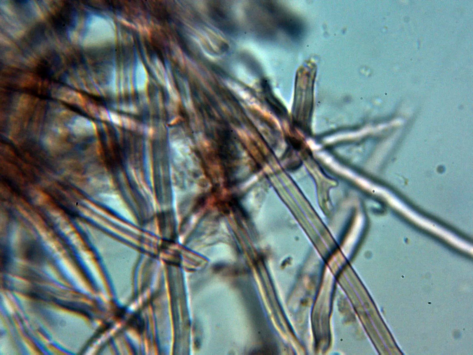Microscopía de Trametes ochracea - 10 - Hifa envolvente